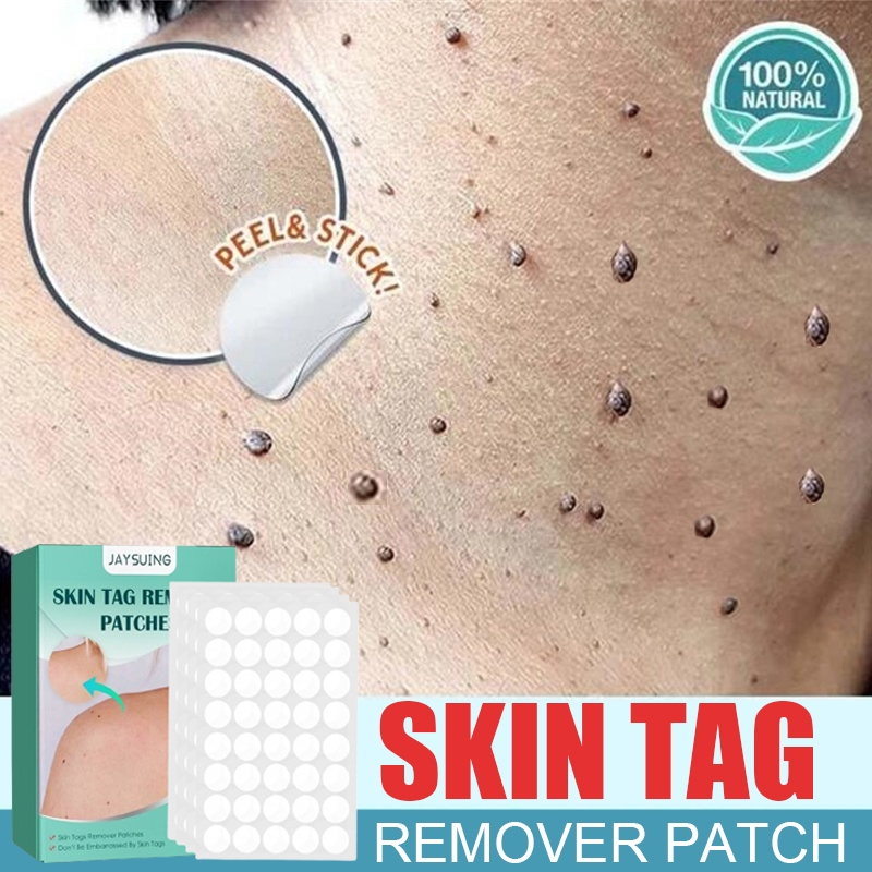 Jual Patch Penghilang Kutil Skin Tag Remover Pcs Wart Remover