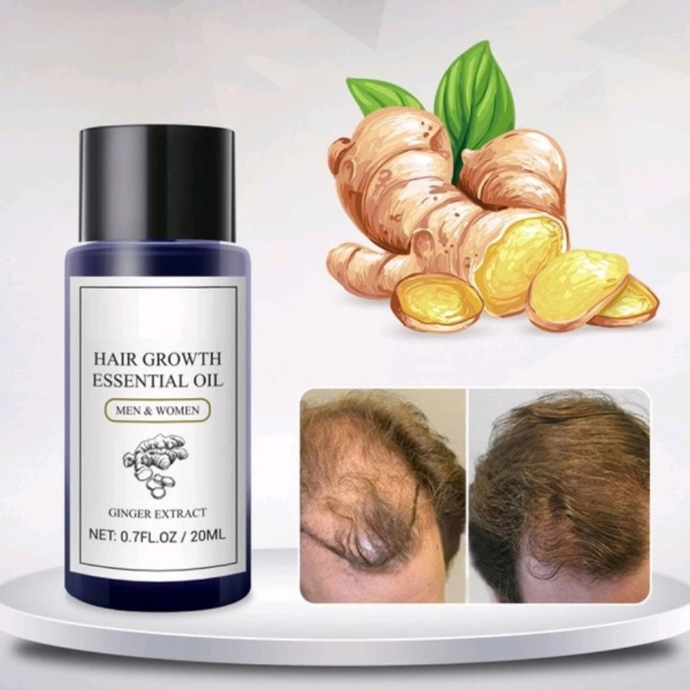 Serum Penumbuh Rambut Dapat Mencegah Kerontokan Rambut Paling Ampuh | AutoStock