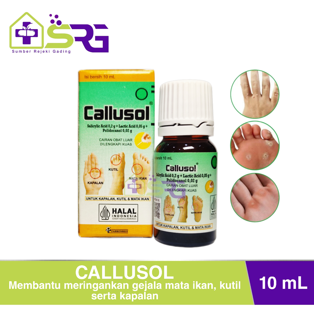 Jual Callusol untuk Menghilangkan Kutil, Mata Ikan, Kapalan 10 mL ...