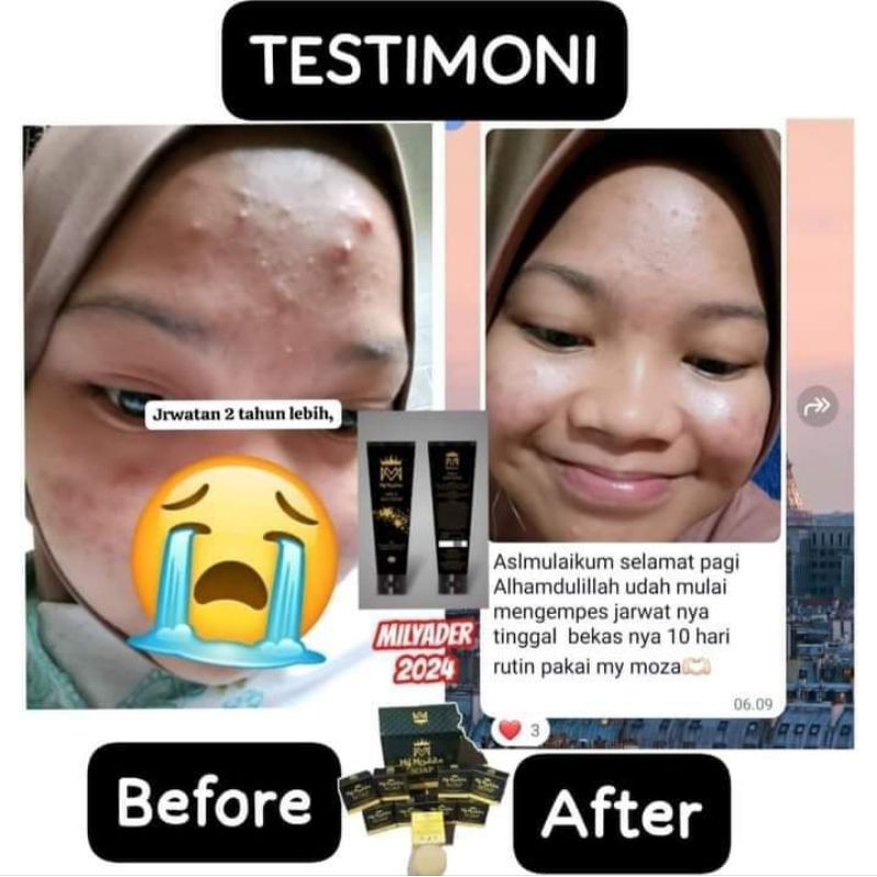 Jual my mozza sabun dan face & body serum | Shopee Indonesia