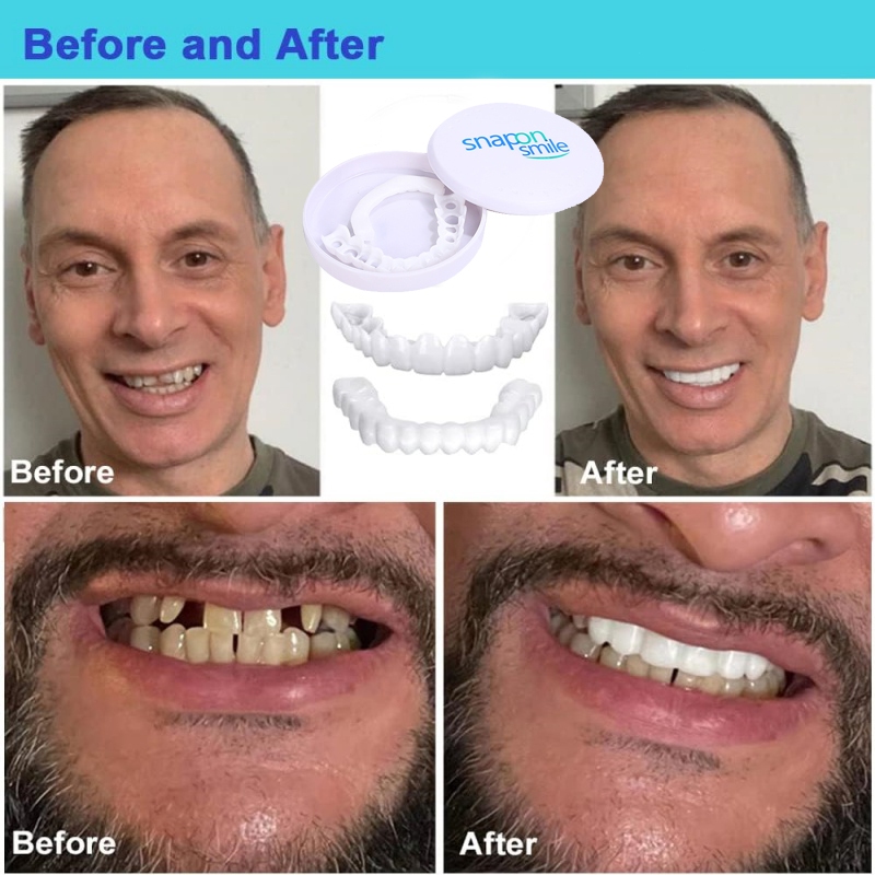 Jual Perapih gigi Aligner gigi Behel gigi original asli dokter Perata ...