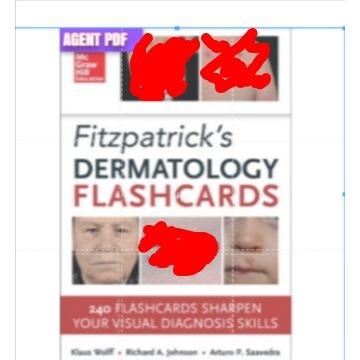 Jual Fitzpatrick’s Dermatology Flash Cards | Shopee Indonesia