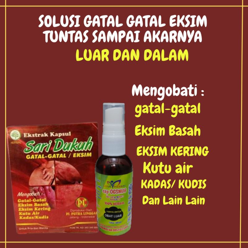 Jual Obat Gatal-Gatal Kulit Eksim Basah Exim Kering Ampuh | Shopee ...