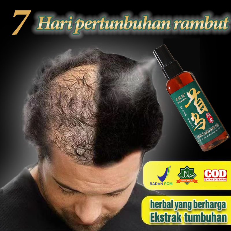 Jual Tonik Rambut Serum 100ml Penumbuh Rambut Serum Anti Rambut Rontok ...