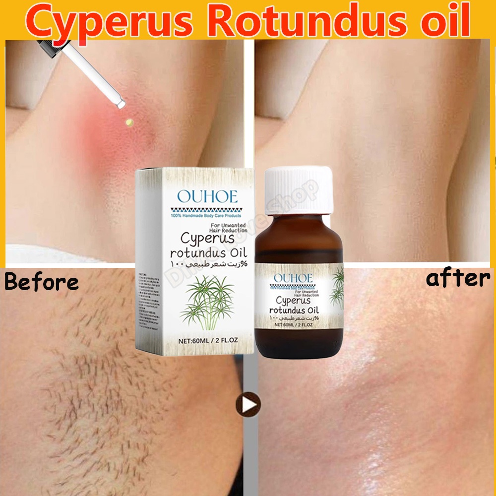 Jual Cyperus Rotundus Oil Hair removal care oil Serum Ketiak Anti ...