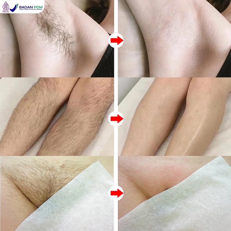 Jual SUSUVETA Perontok bulu permanen asli Cukur ketiak wanita Hair ...