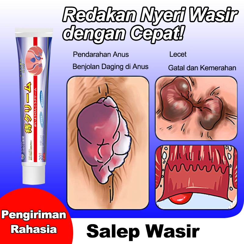 Jepang Obat wasir Salep wasir Salep ambeien paling ampuh 20g Meredakan ketidaknyamanan wasir Formulasi herbal alami yang lebih baik Mengatasi gatal dan bengkak di anus