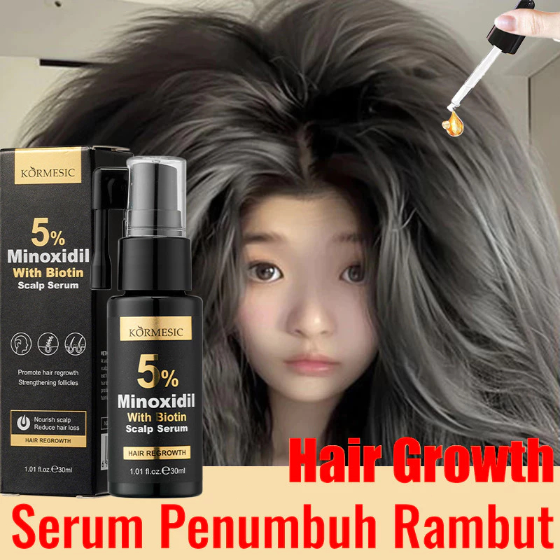 Jual Hair growth serum 30ml penumbuh rambut botak serum Minoxidil 5% ...