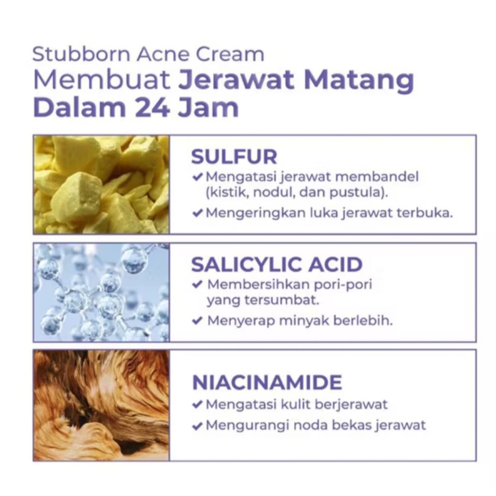 Jual Acnaway Acne Treatment Cream 20gr | Shopee Indonesia