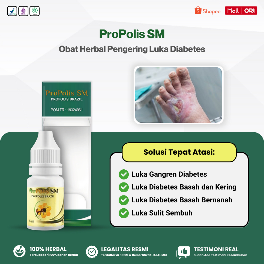 Obat Luka Diabetes, Obat Pengering Luka Diabetes Penyakit Gula Kencing Manis, Obat Luka Bernanah dan Basah, Obat Luka Cepat Kering, Obat Luka Diabetes Basah Bernanah, Propolis SM PALING AMPUH EFEKTIF Tapi SETIAP ORANG HASILNYA BERBEDA