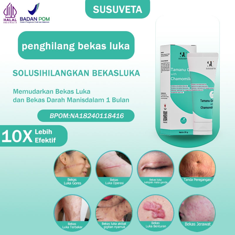 Jual SUSUVETA Obat penghilang bekas luka Penghilang bekas luka hitam ...