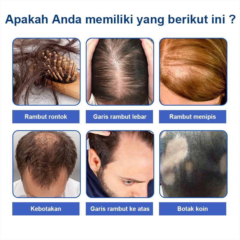 Jual 100% ORI Obat Penumbuh Rambut | Penumbuh Rambut Botak | Obat ...