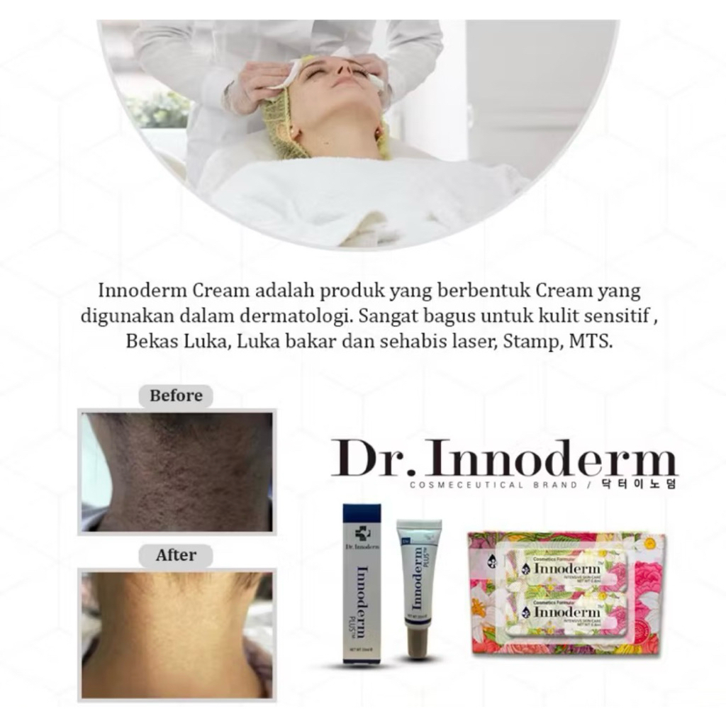 Jual Dr. INNODERM cream plus antiiritasi soothing cream (BPOM) | Shopee ...
