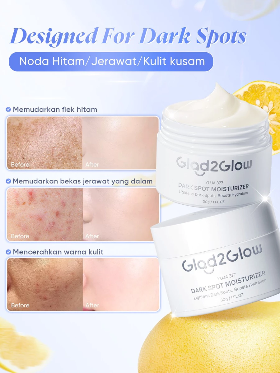  Dark Spot Moisturizer