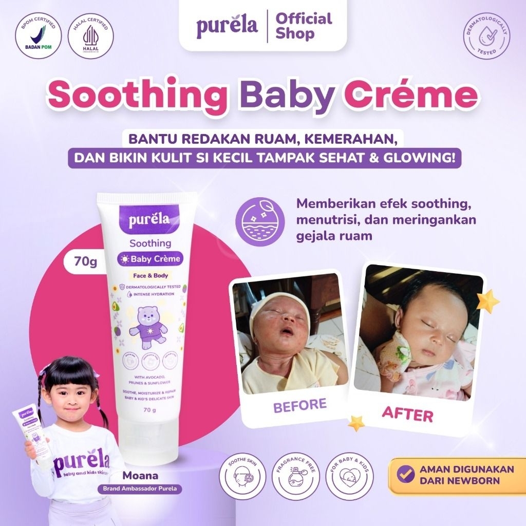 Jual Purela Soothing Baby Creme 70gr - Krim Untuk Membantu Mengurangi ...