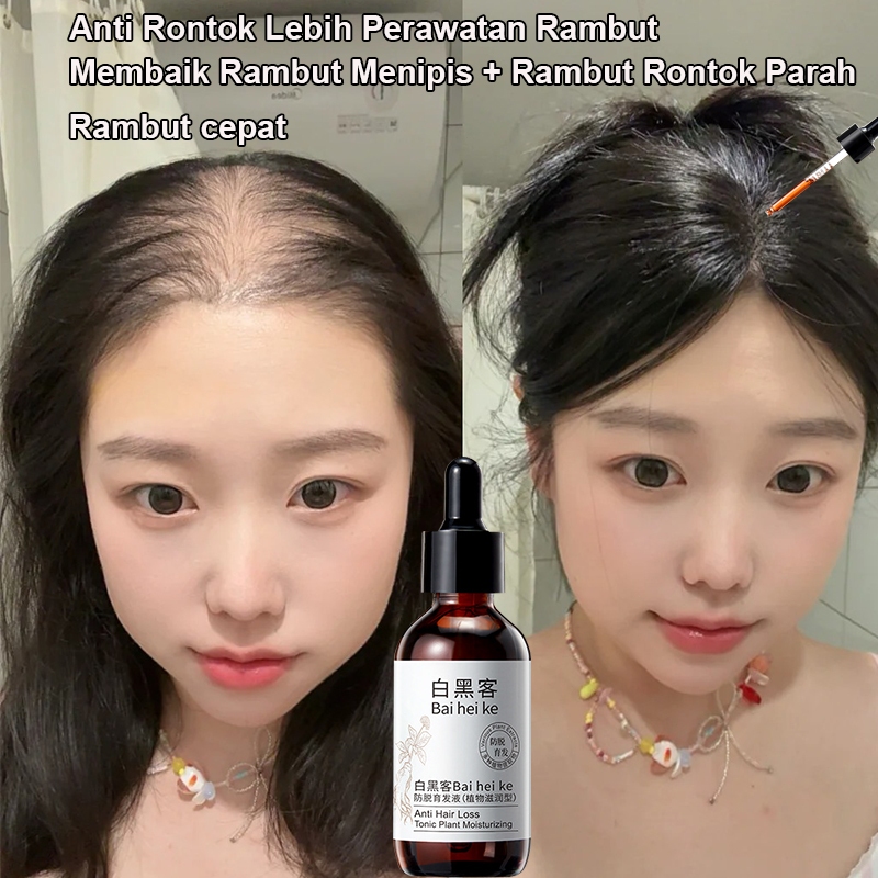 Jual serum penumbuh rambut penumbuh rambut penumbuh rambut cepat dan ...