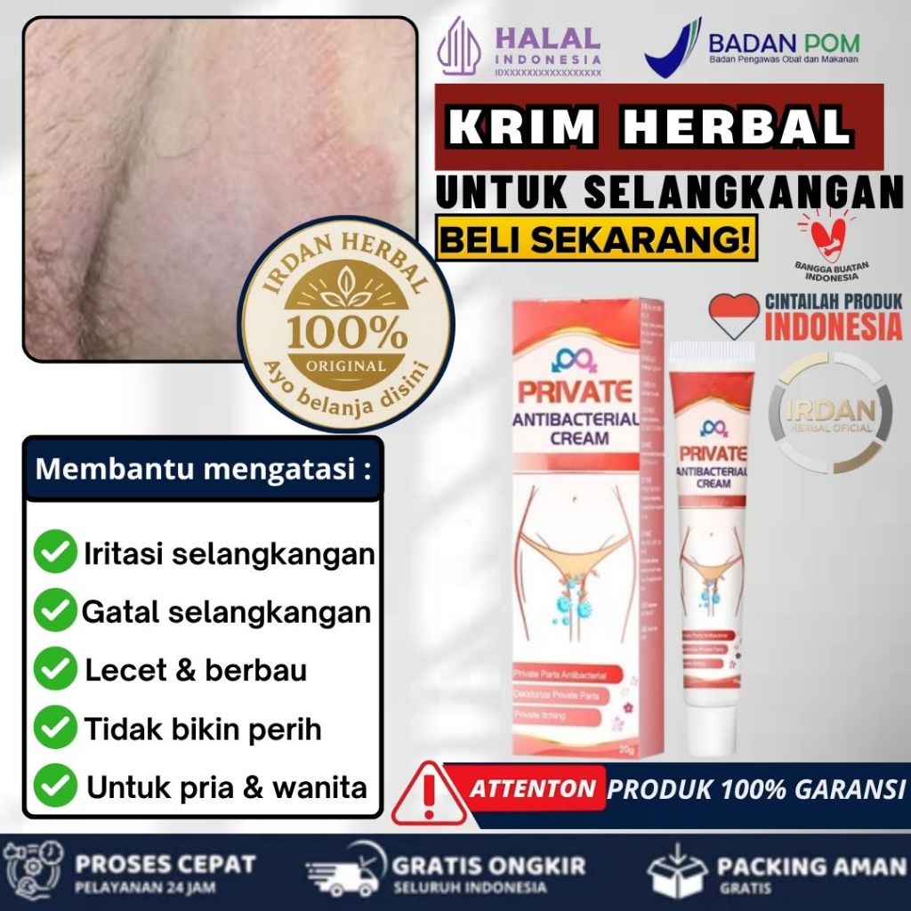 Jual Obat Jamur Kulit & Gatal Lipatan Paha — Sumifun Cream Area ...