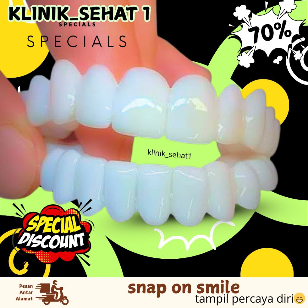 Jual ( cod ) snap on smile terpopuler 1set bawah dan atas ORIGINAL ...