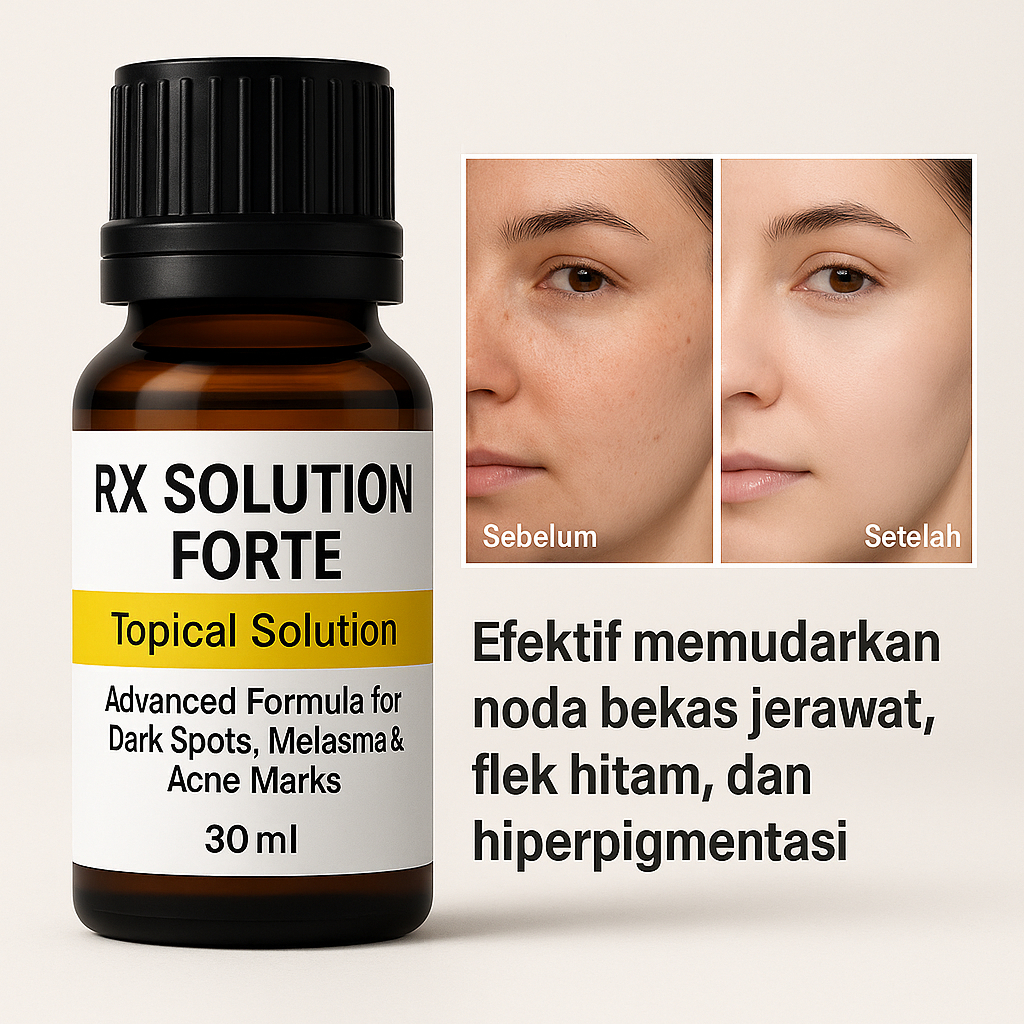 Jual RX SOLUTION MENGHILANGKAN FLEK BANDEL DAN BEKAS JERAWAT CAIRAN ...