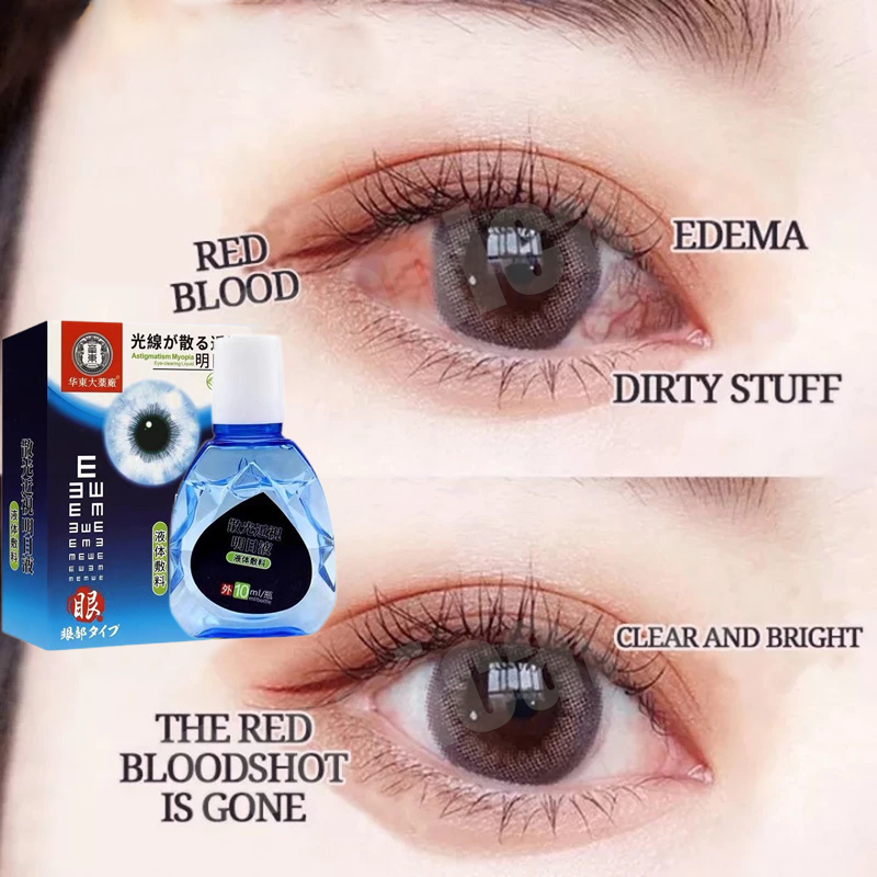 Jual Obat tetes mata Tetes Mata obat mata katarak eye drop Mata kering ...