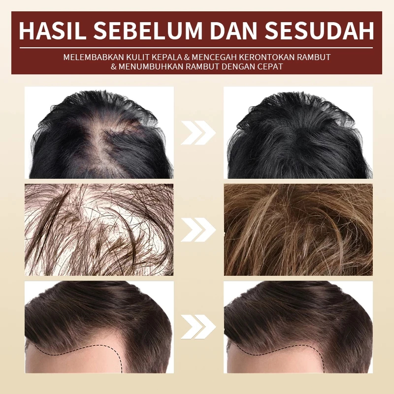 Jual shampoo penumbuh rambut cepat Ginger Shampoo shampoo penumbuh ...
