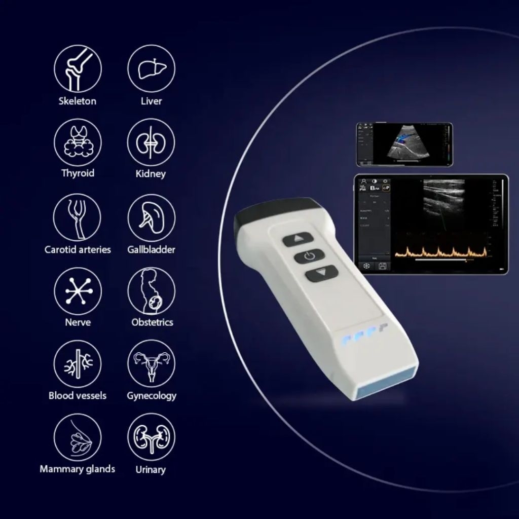 Jual USG WIRELESS USB ULTRASOUND DEVICE HANDHELD COLOR DOPPLER | Shopee ...