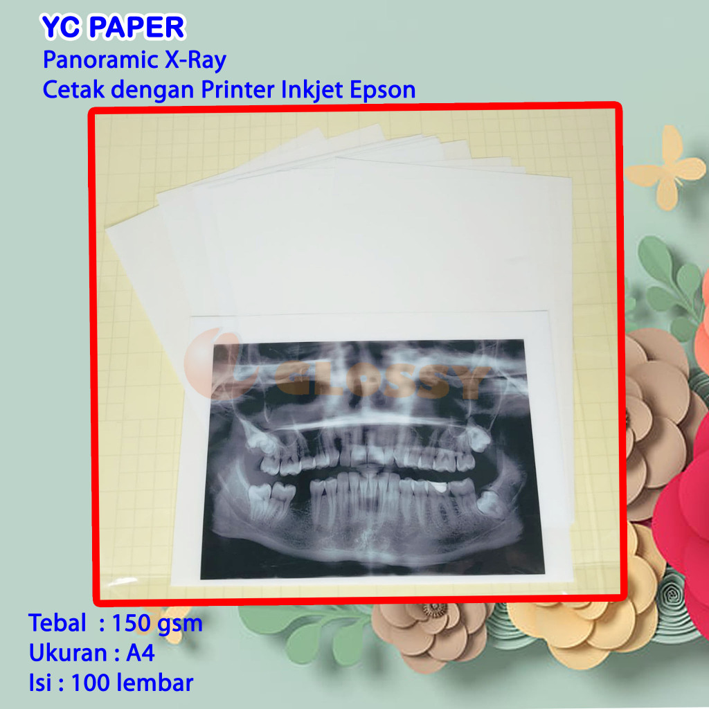 Jual YC Paper Panoramic X-Ray Cetak dengan Printer Inkjet Epson ...