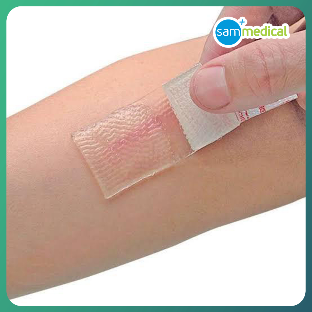 Jual CICA CARE Silicone Gel Sheet / Penghilang Bekas Luka Operasi Dan ...