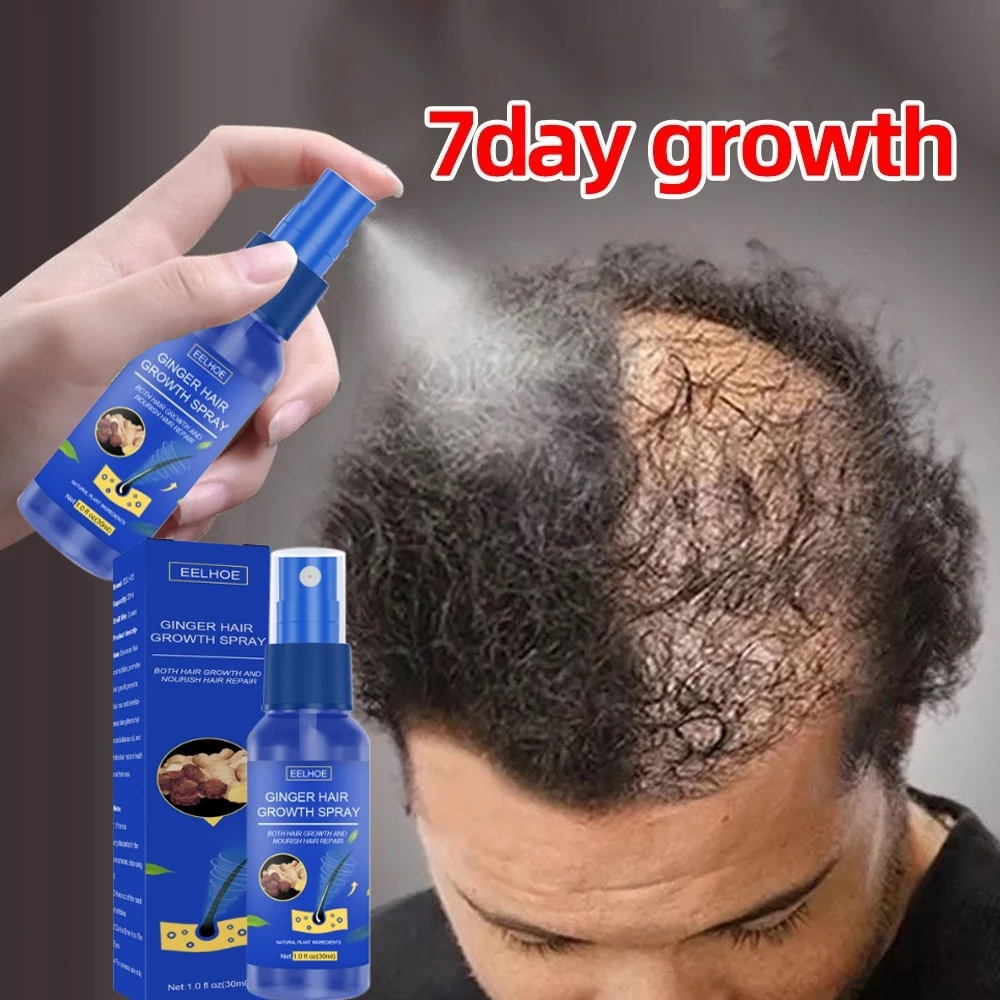 Jual Ginger Hair Growth Spray Penumbuh Rambut Botak Cairan Serum Anti ...