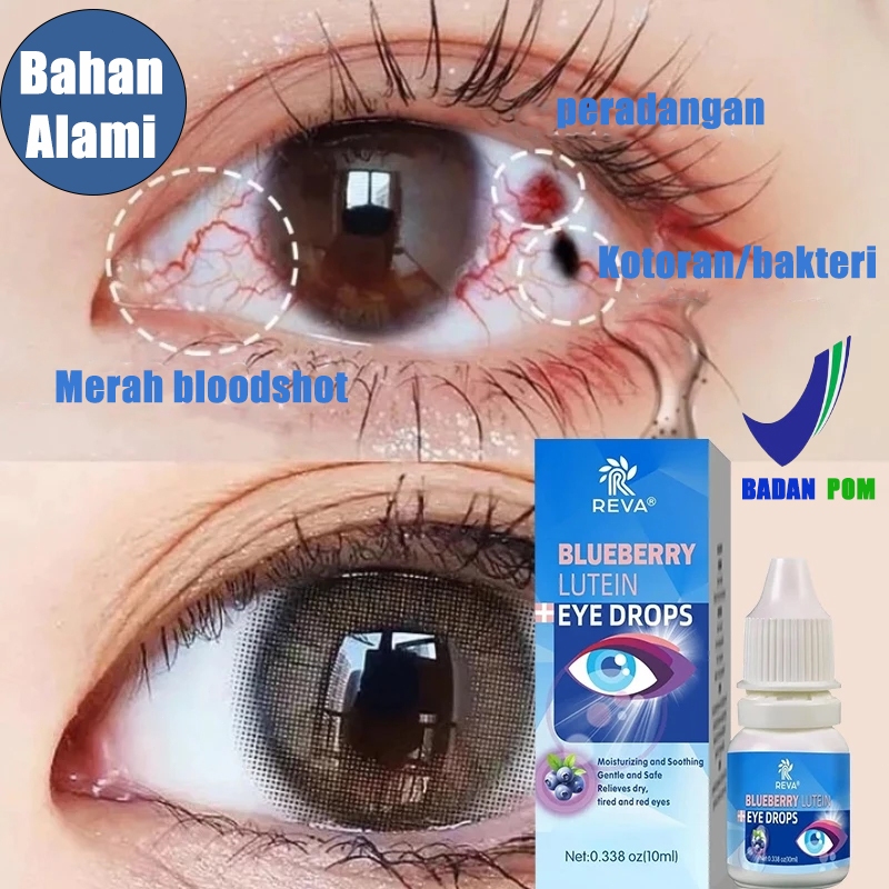 Jual Tetes mata lutein Eye drop blueberry 10ml mata lelah Tetes mata ...