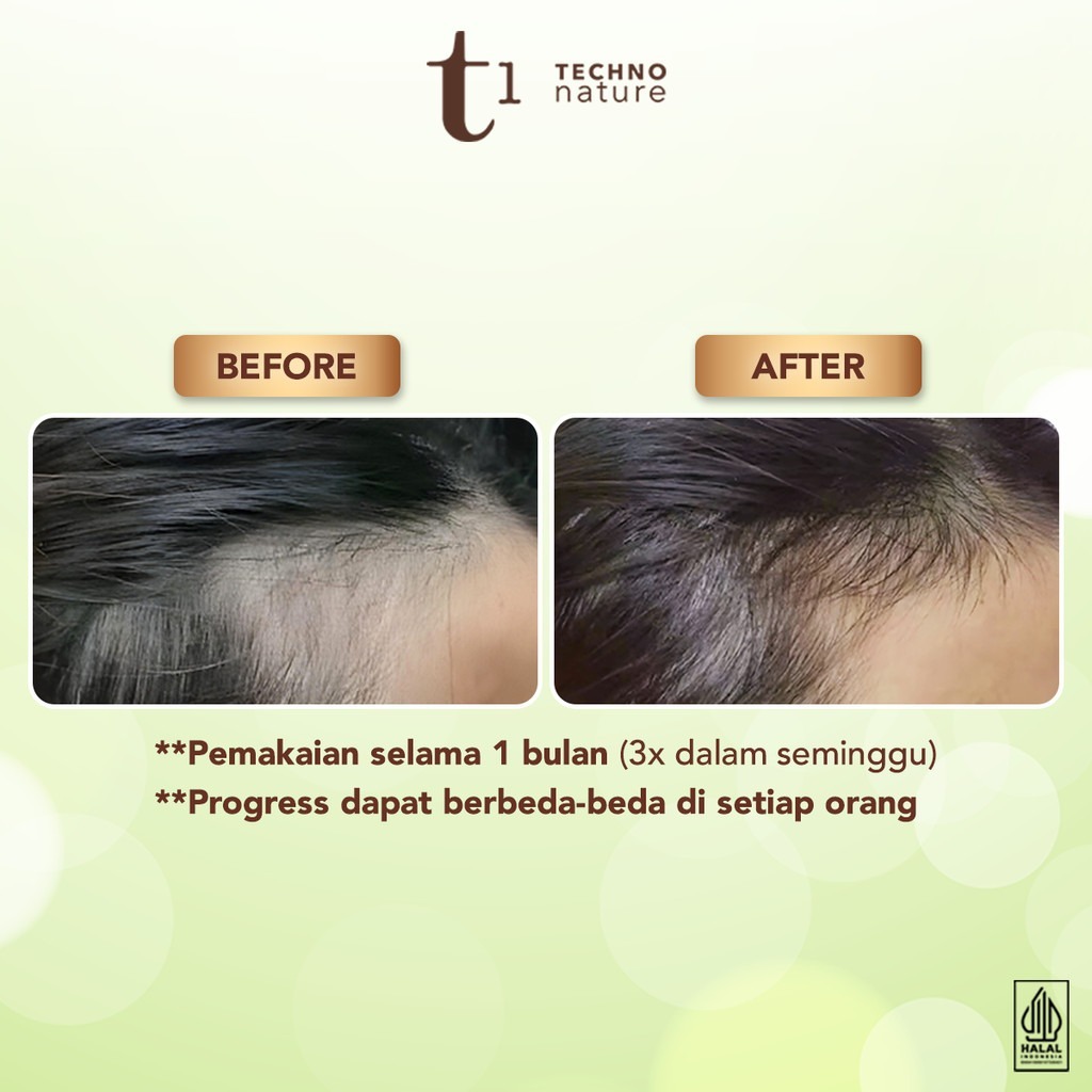 Jual (ORIGINAL) Makarizo T1 Techno Nature Rosemary Scalp & Hair Oil ...