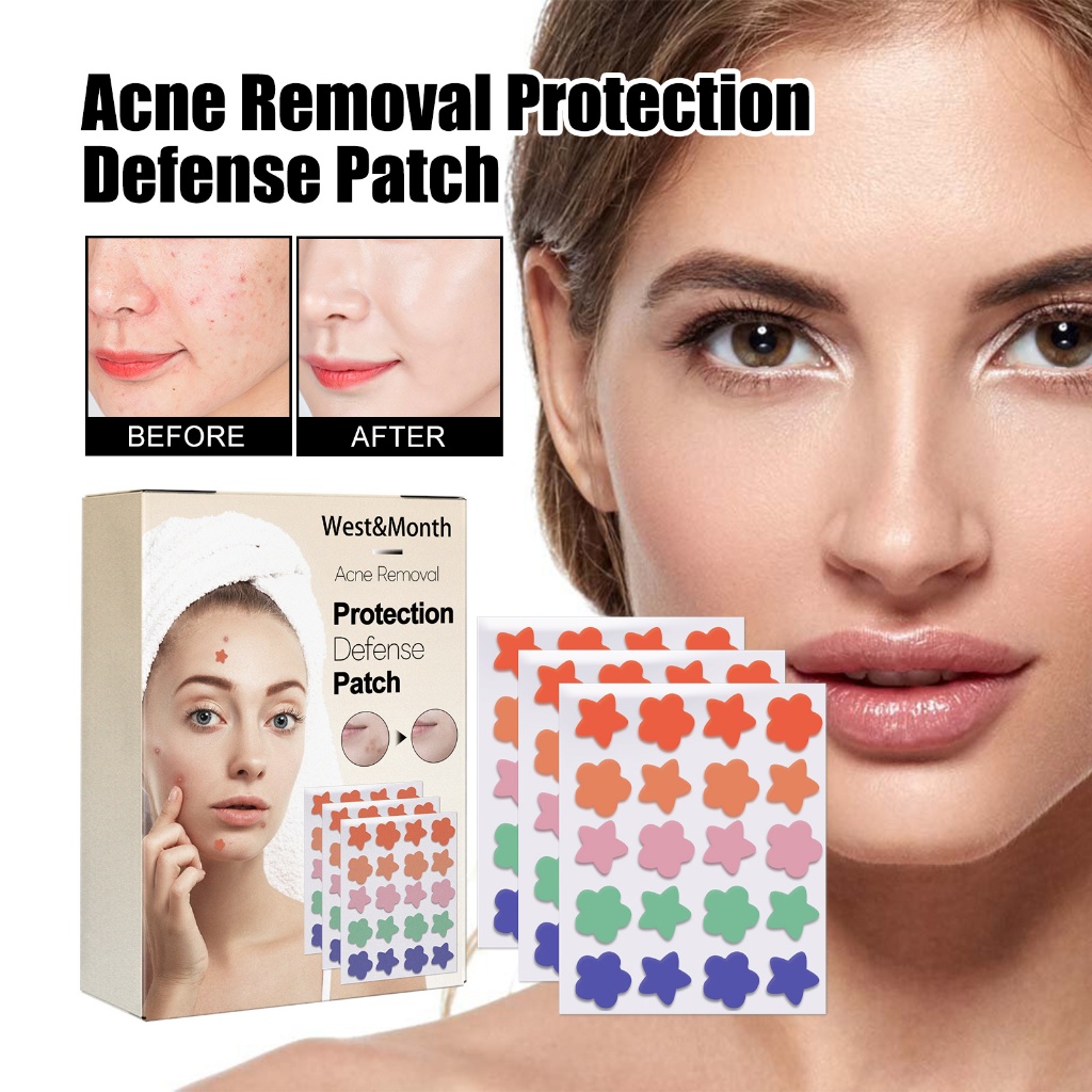 Jual West&Month Cute Star Acne Scar Sticker 60pcs Inflamed Acne Acne ...