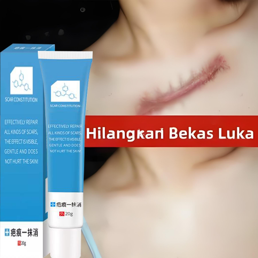 Jual scar removal original scars remover for face old scars fixscar by ...