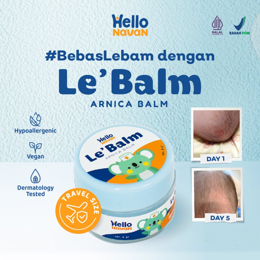 Jual [GIMMICK SAMPLE TIDAK UNTUK DIJUAL] Hello Navan Le Balm Arnica ...