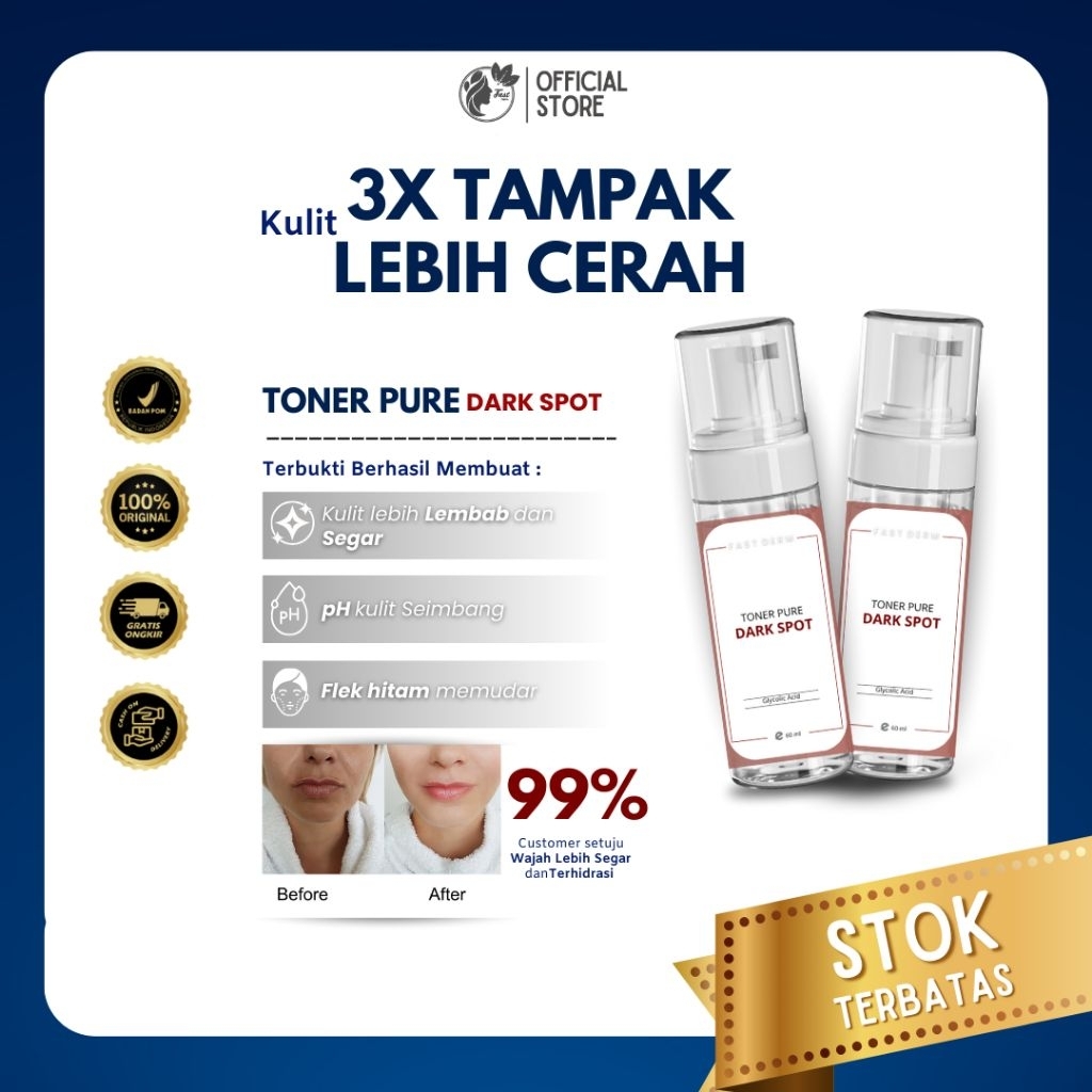 Jual TONER PURE DARK SPOT NEW 60 ML | Shopee Indonesia