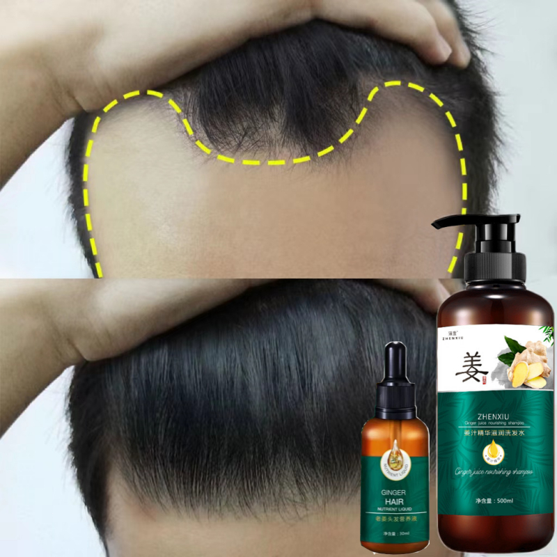 Jual [100% asli] Shampo penumbuh rambut cepat Ginger shampoo botak ...