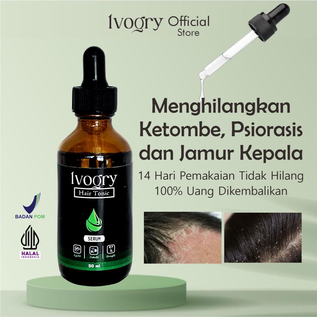 Ivogry Scalp Care – Serum Harian Kulit Kepala foto 1