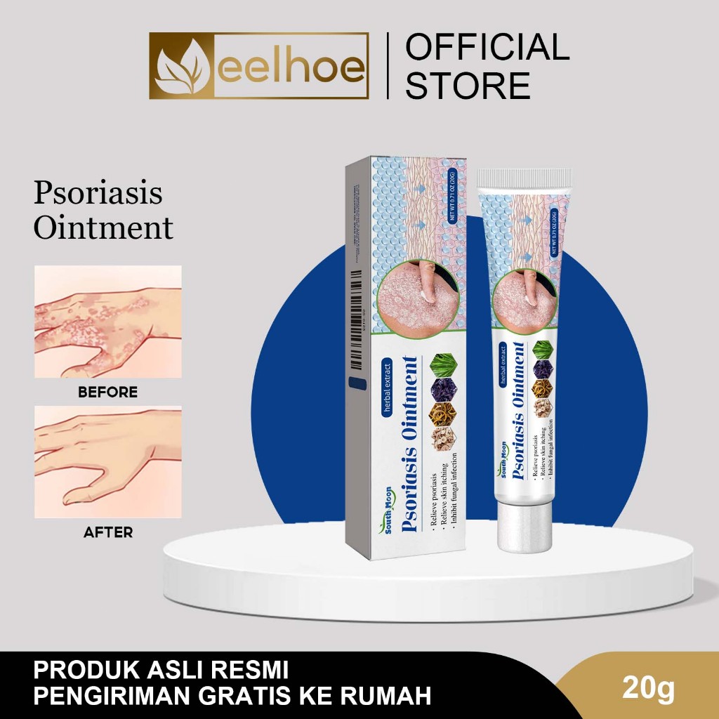 Jual South Moon Krim Psoriasis 20g Pelembab Dan Menutrisi Kulit Salep ...