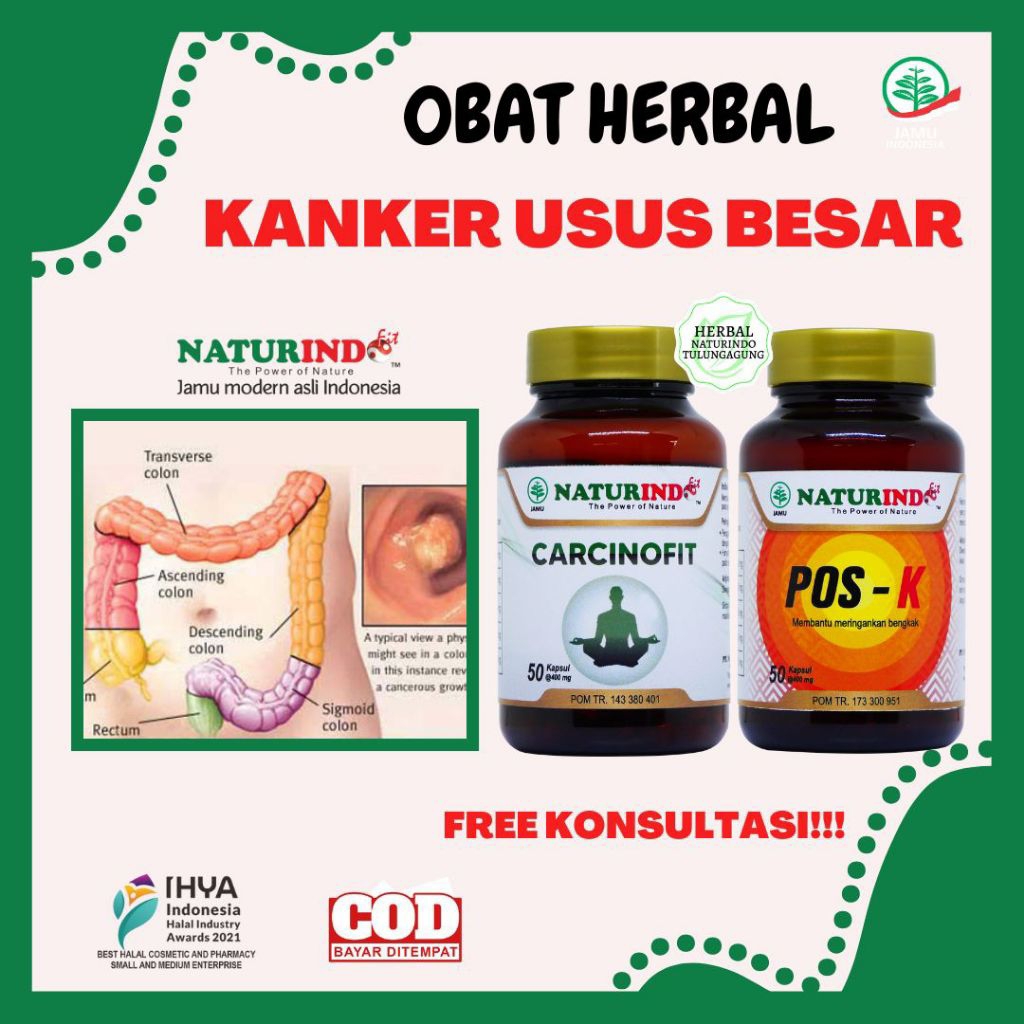 Obat Kanker Usus Besar Kolon Radang Usus Benjolan Herbal Tumor Usus Besar Kanker Payudara Carcinofit Naturindo