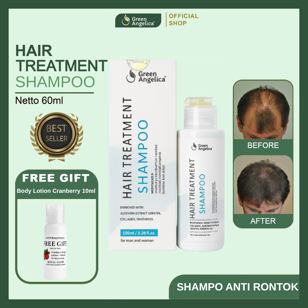 Green Angelica Shampoo Anti Rontok Penumbuh Rambut Ketombe Lepek Herbal BPOM 100ml