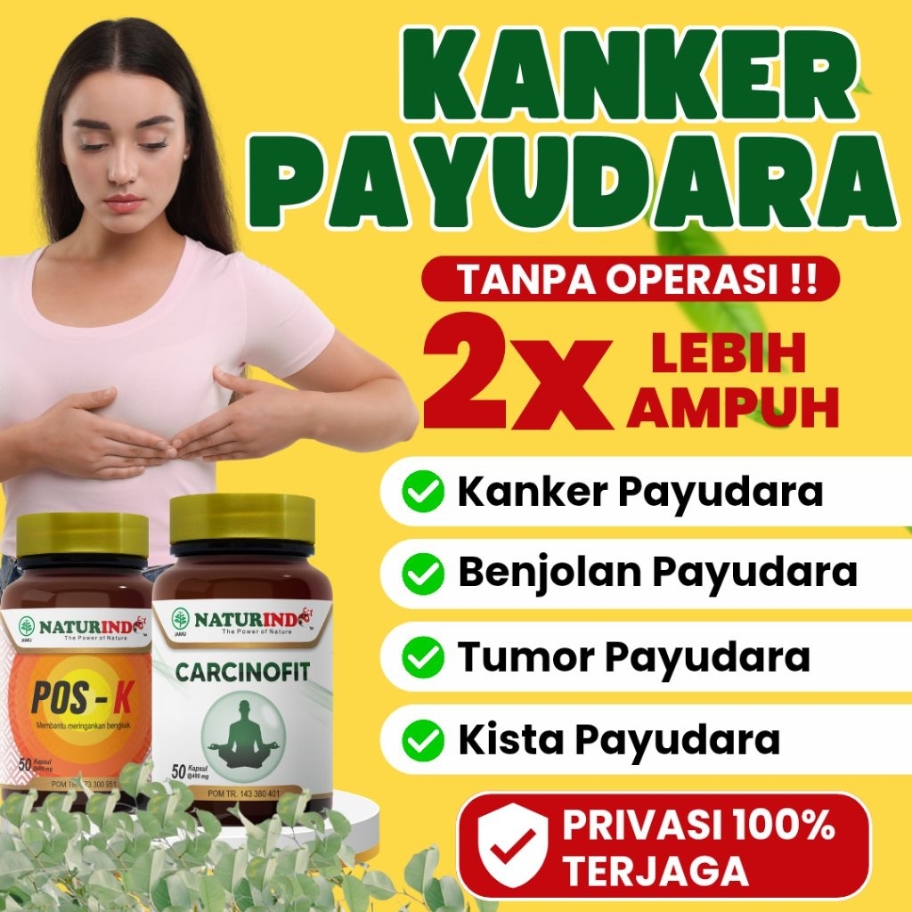 Obat Kanker Payudara Kanker Serviks Kanker Otak Pembunuh Virus Tumor Payudara Karsinoma