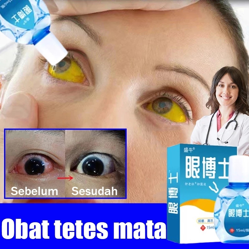 Jual COD Obat Mata 15ml /Tetes Mata Katarak Obat Tetes Mata Obat Sakit ...