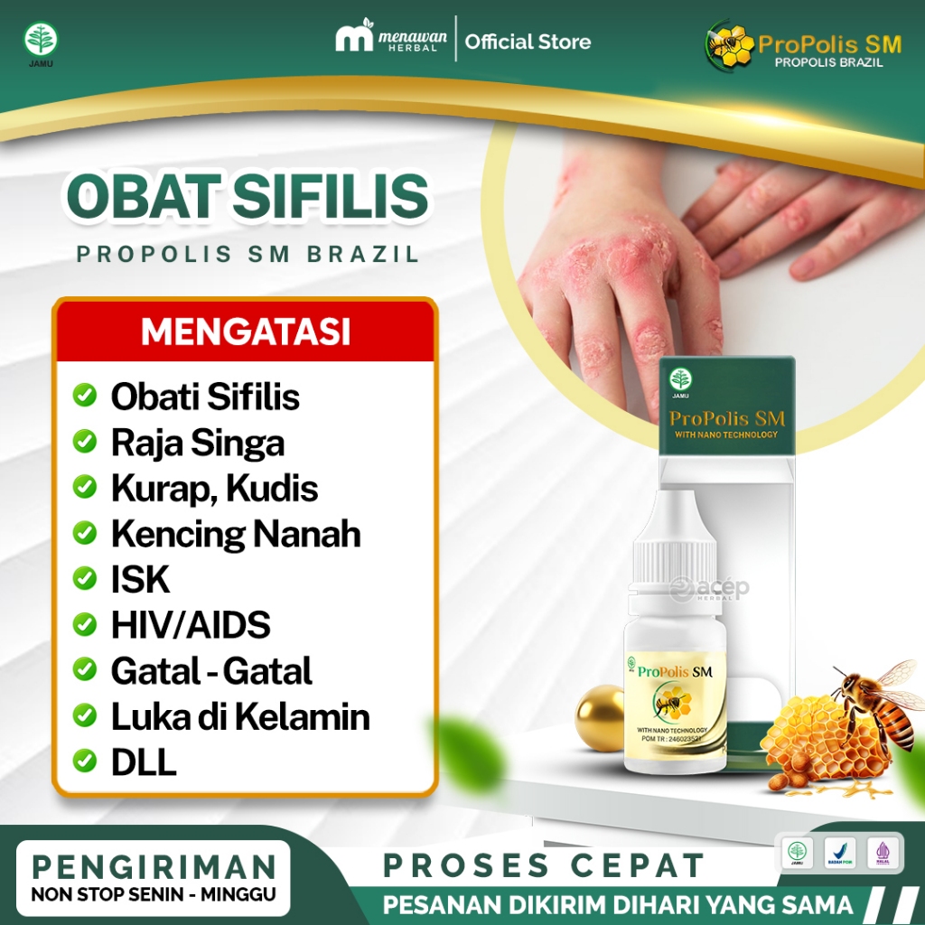 Obat Herbal Sipilis, Gonore, Kencing Nanah, Berdarah, HIV/AIDS, Meningkatkan Imun, Raja Singa, Infeksi Saluran Kencing, Kista, Hernia, Kutil Kelamin, Sakit Tenggorokan, Ruam Pada Tubuh, Limfa, Trikomosis, Sinusitis - PROPOLIS SM BRAZILIAN 100% ORIGINAL