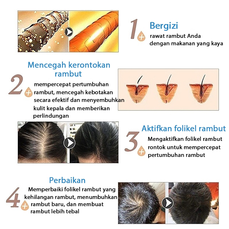 Jual Hair serum penumbuh rambut minyak penumbuh rambut cepat obat ...