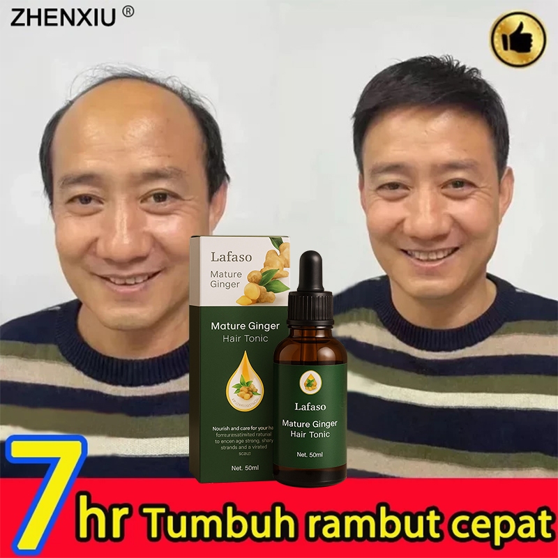 Jual hair tonic-penumbuh rambut botak Menyehatkan Kulit Kepala ...