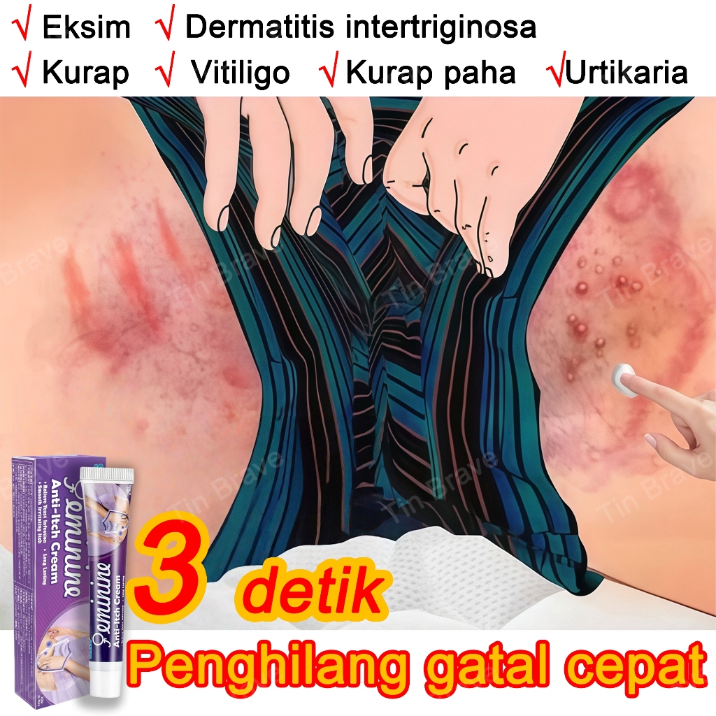 Jual salep gatal selangkangan 35g salep eksim kering dan gatal salep ...
