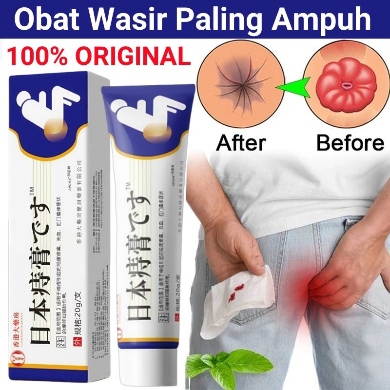 Jaminan Privasi Japan Krim Obat Wasir Paling Ampuh Salep Wasir Ambeien Untuk Pria dan Wanita Original Mengobati Gatal Atau Iritasi/Sakit/Merah/Bengkak Di Sekitar Anus - Hemorrhoid Cream 20g
