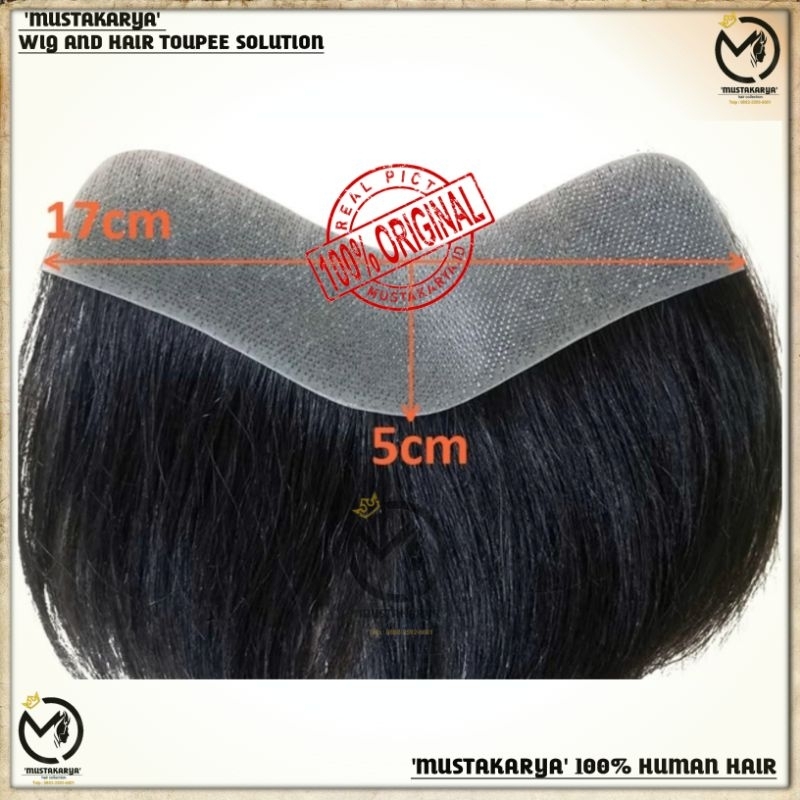 Jual Hair Toupe Toupee Hairline Frontal Pony Botak M Botak Oval/ Tutup ...