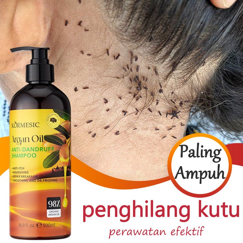 Jual Shampo Anti Ketombe Penghilang Ketombe Anti Gatal Shampoo 500ml