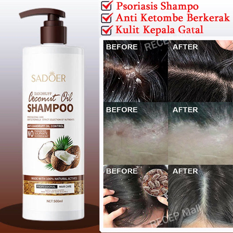 Jual shampo anti ketombe shampoo ketombe berkerak shampoo psoriasis